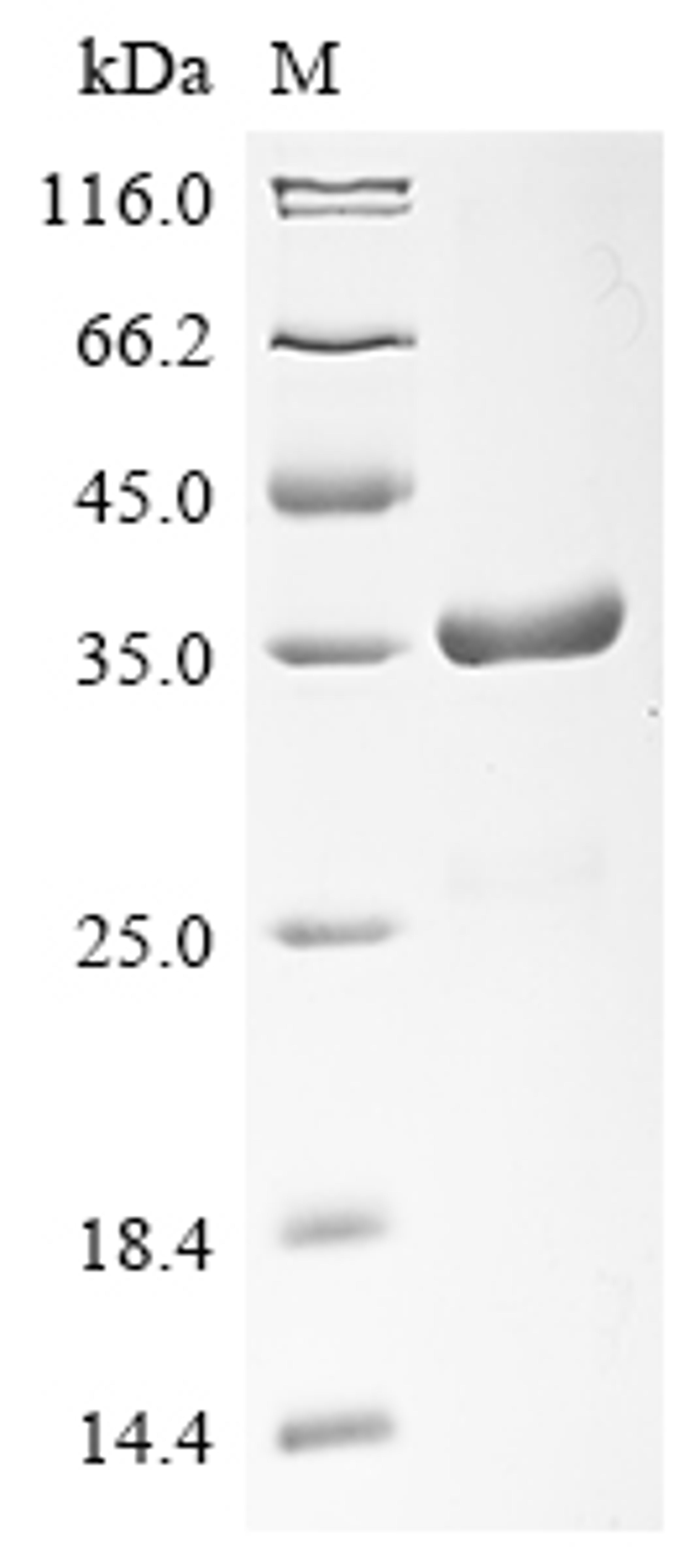 (Tris-Glycine gel) Discontinuous SDS-PAGE (reduced) with 5% enrichment gel and 15% separation gel.
