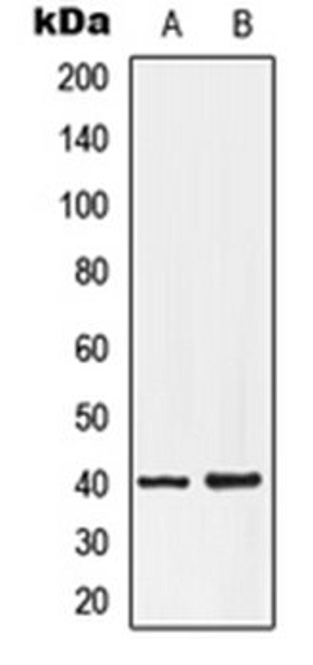 Western blot analysis of HepG2 (Lane 1), NT2D1 (Lane 2) whole cell lysates using LPAR3 antibody