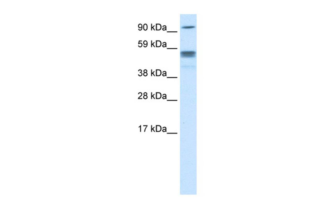 Antibody used in WB on Human cerebellum at 0.2-1 ug/ml.