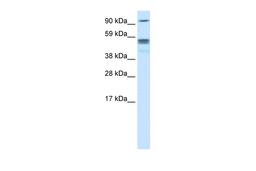 Antibody used in WB on Human cerebellum at 0.2-1 ug/ml.