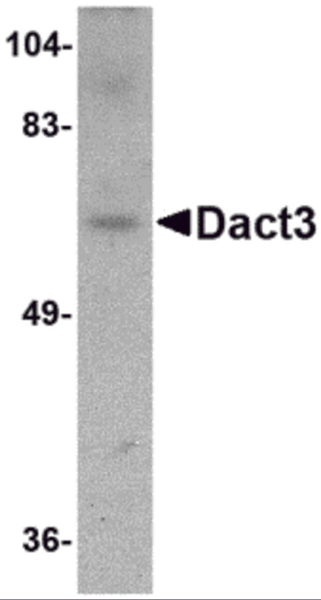 Western blot analysis of Dact3 in rat brain tissue lysate with Dact3 antibody at 1 &#956;g/mL.