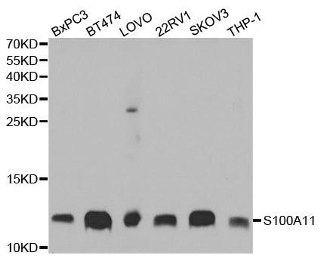 Western blot analysis of extracts of various cell lines using S100A11 antibody