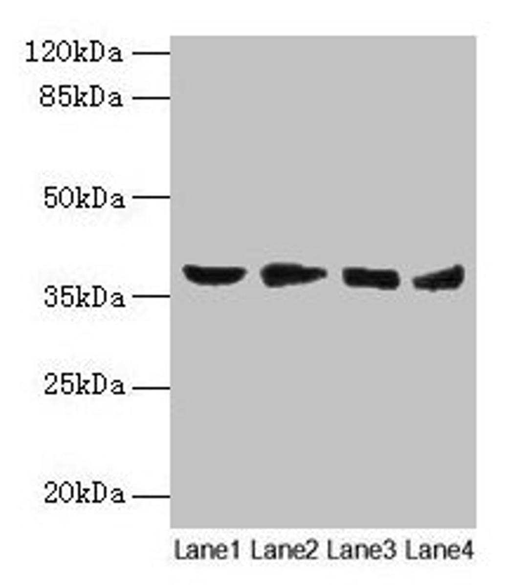 Western blot. All lanes: AKR1C2 antibody at 14µg/ml. Lane 1: HepG2 whole cell lysate. Lane 2: MCF-7 whole cell lysate. Lane 3: Hela whole cell lysate. Lane 4: Rat liver tissue. Secondary. Goat polyclonal to rabbit IgG at 1/10000 dilution. Predicted band size: 37, 16 kDa. Observed band size: 37 kDa