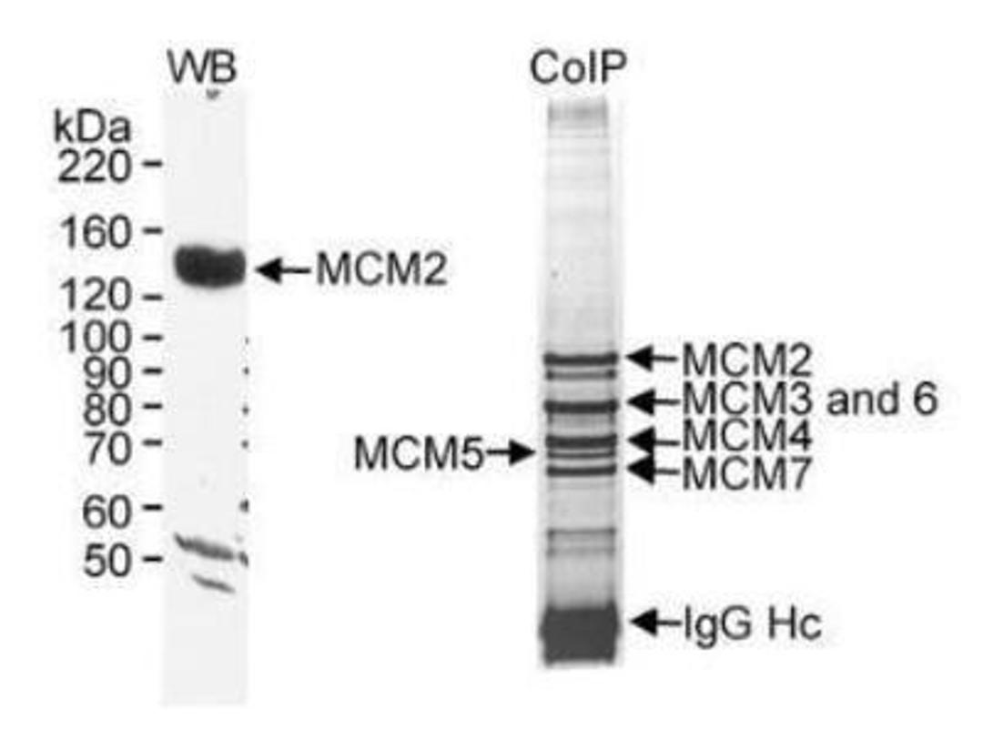 Western Blot: MCM2 Antibody [NB100-288] - RIPA extract (50 mcg for WB; 7 mg for CoIP) from HeLa cells. Affinity purified rabbit anti-MCM2  used at 0.2 mcg/ml for WB and 20 mcg/7mg extract for IP