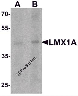 Western blot analysis of LMX1A in rat brain tissue lysate with LMX1A antibody at (A) 1 and (B) 2 &#956;g/mL.