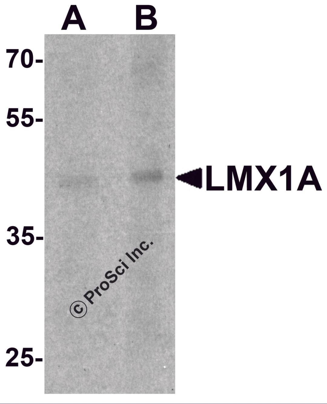Western blot analysis of LMX1A in rat brain tissue lysate with LMX1A antibody at (A) 1 and (B) 2 μg/mL.