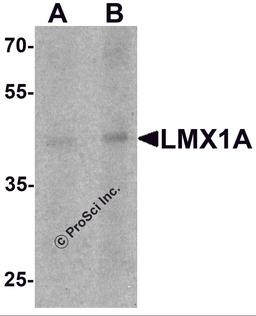 Western blot analysis of LMX1A in rat brain tissue lysate with LMX1A antibody at (A) 1 and (B) 2 μg/mL.