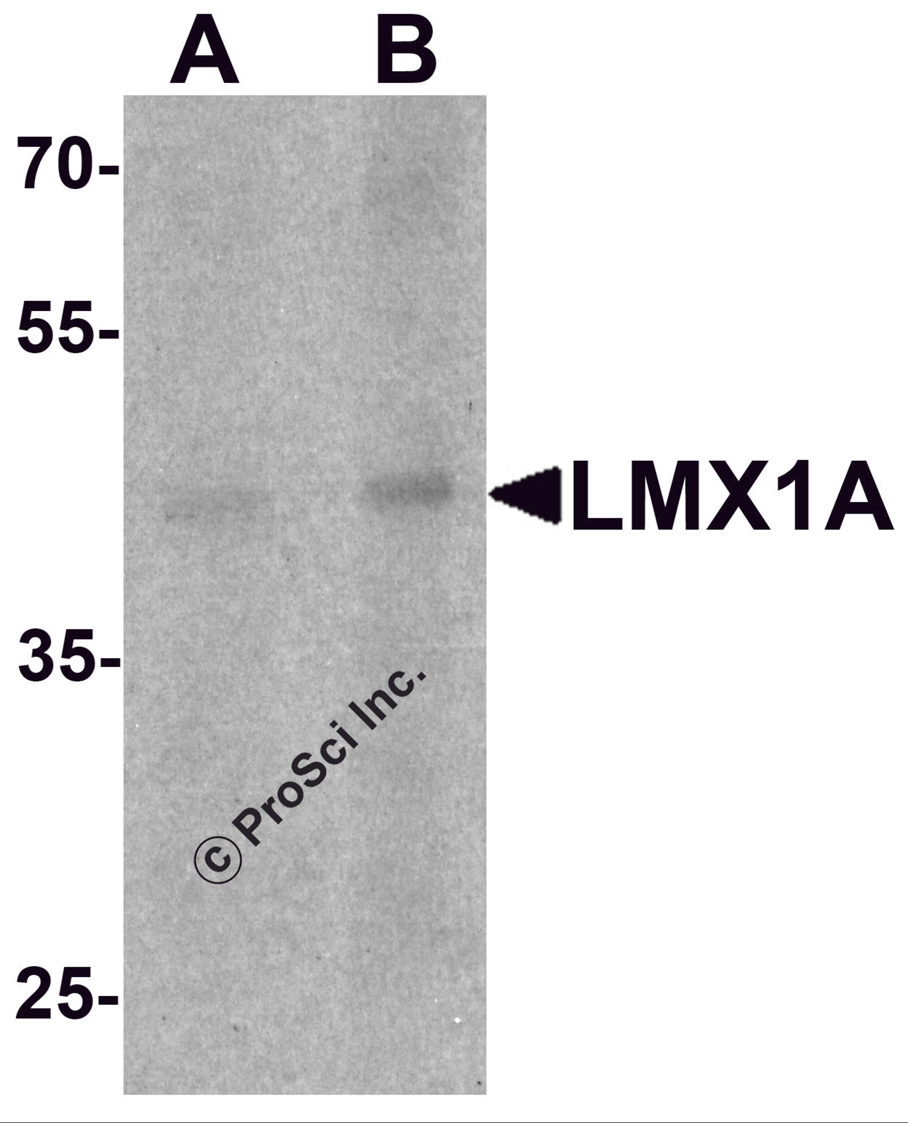 Western blot analysis of LMX1A in rat brain tissue lysate with LMX1A antibody at (A) 1 and (B) 2 μg/mL.