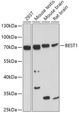 Western blot - BEST1 antibody (A3022)