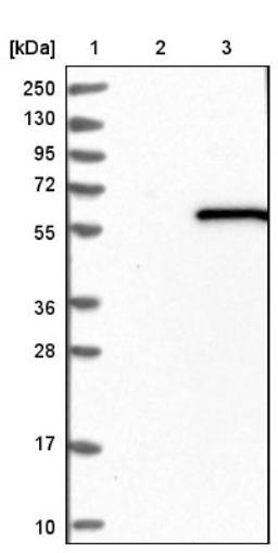 Immunohistochemistry: CARKL Antibody [NBP1-91151] - Lane 1: Marker [kDa] 250, 130, 95, 72, 55, 36, 28, 17, 10<br/>Lane 2: Negative control (vector only transfected HEK293T lysate)<br/>Lane 3: Over-expression lysate (Co-expressed with a C-terminal myc-DDK tag (~3.1 kDa) in mammalian HEK293T cells, LY415695)