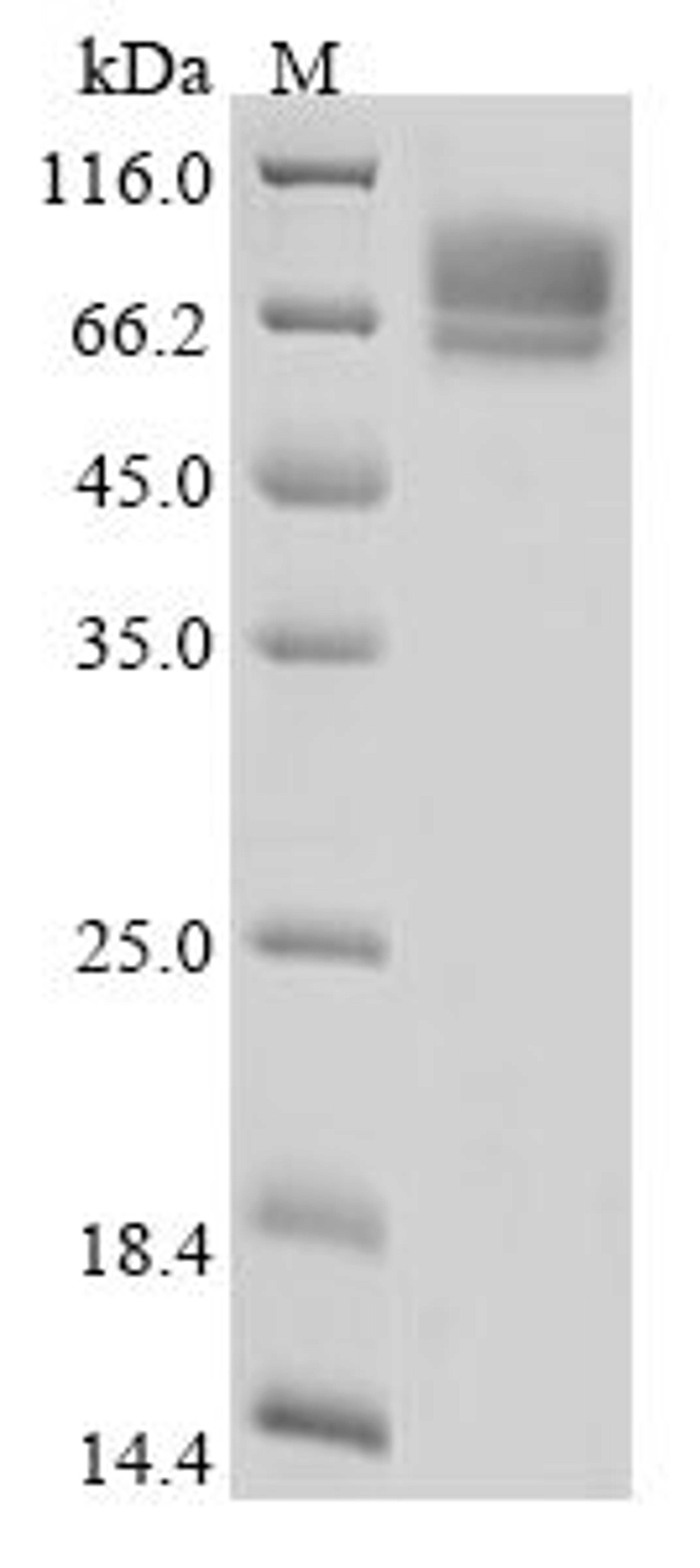 (Tris-Glycine gel) Discontinuous SDS-PAGE (reduced) with 5% enrichment gel and 15% separation gel.
