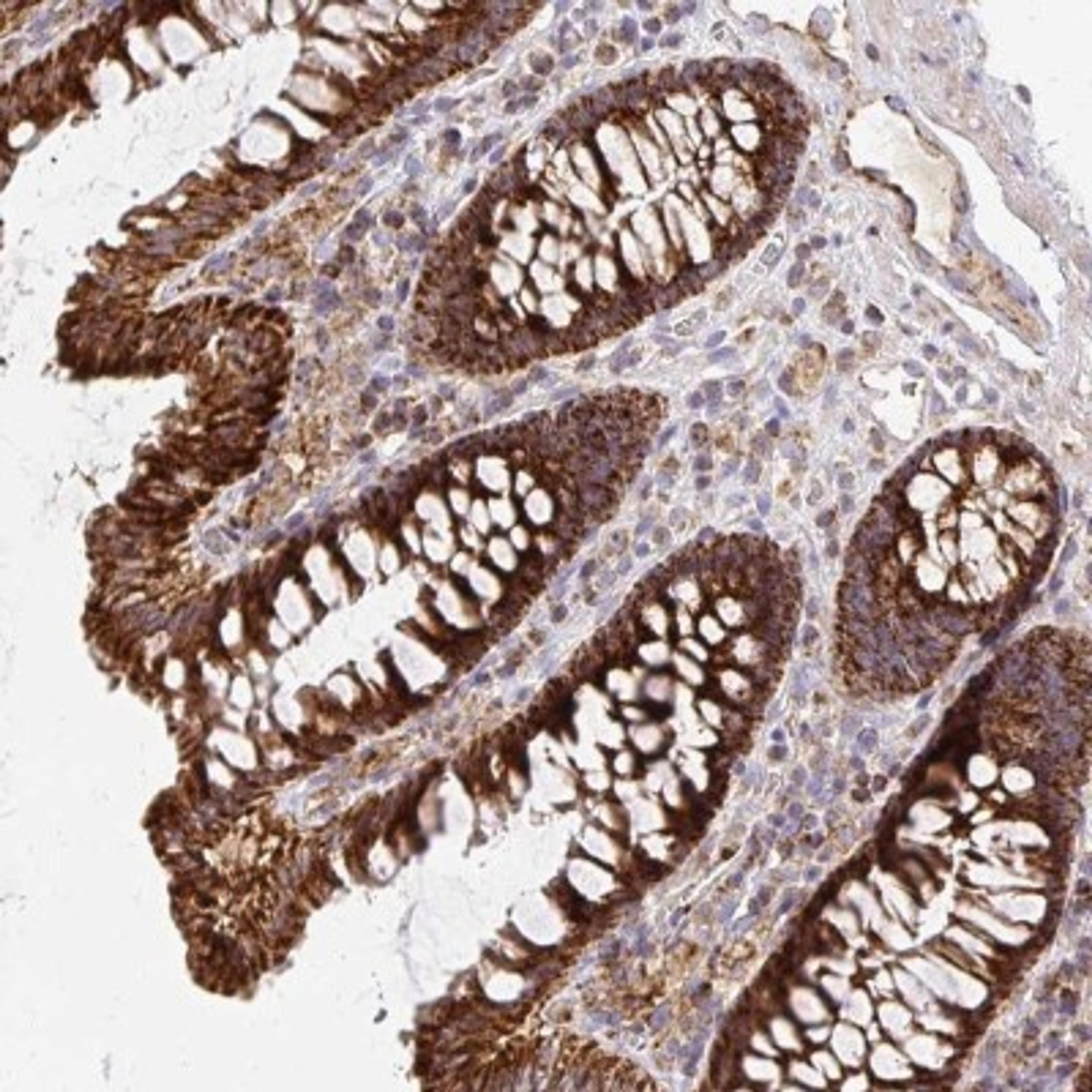 Immunohistochemistry: MRPL13 Antibody [NBP2-32572] - Staining of human colon shows strong cytoplasmic positivity in glandular cells.