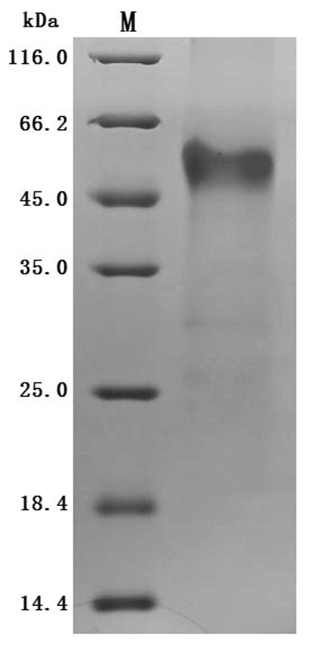 (Tris-Glycine gel) Discontinuous SDS-PAGE (reduced) with 5% enrichment gel and 15% separation gel.