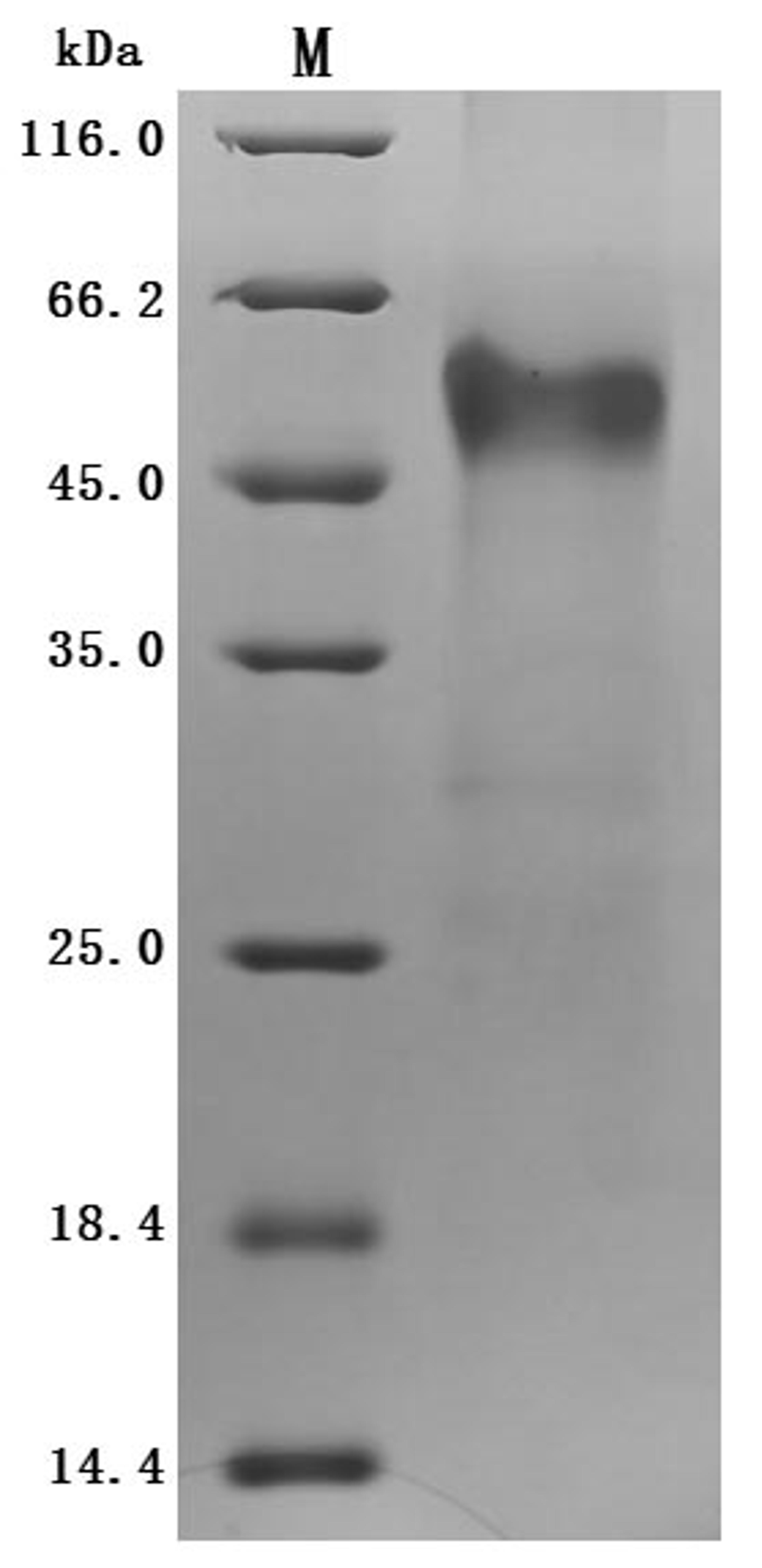 (Tris-Glycine gel) Discontinuous SDS-PAGE (reduced) with 5% enrichment gel and 15% separation gel.