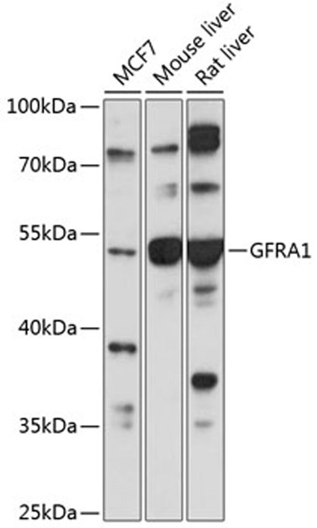Western blot - GFRA1 antibody (A2953)
