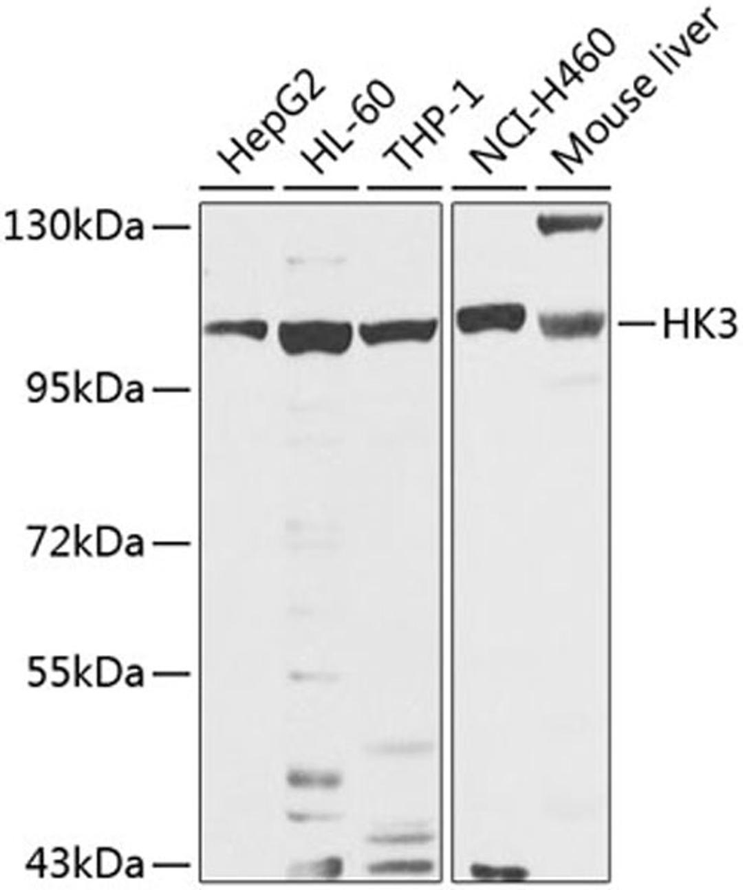 Western blot - HK3 antibody (A8428)