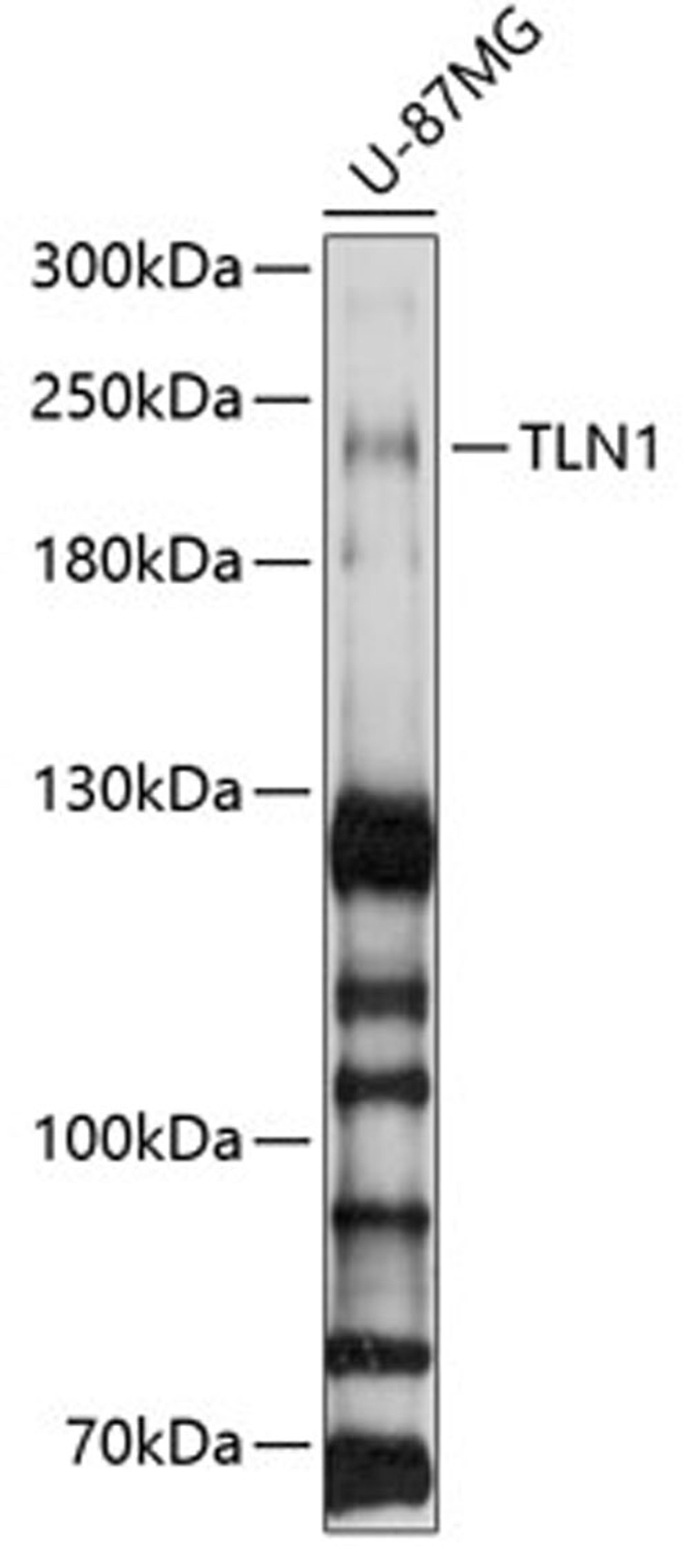 Western blot - TLN1 antibody (A4158)