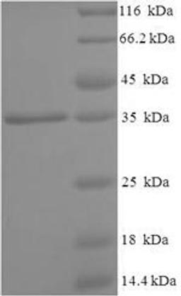 (Tris-Glycine gel) Discontinuous SDS-PAGE (reduced) with 5% enrichment gel and 15% separation gel.