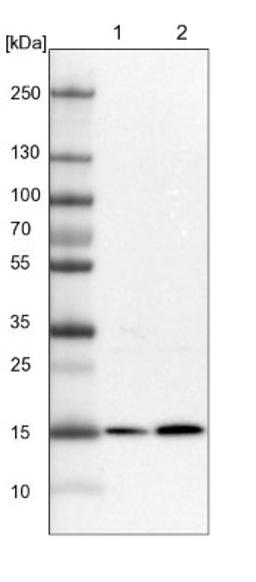 Western Blot: RWDD4A Antibody [NBP1-84743] - Lane 1: Mouse liver tissue lysate<br/>Lane 2: Rat liver tissue lysate