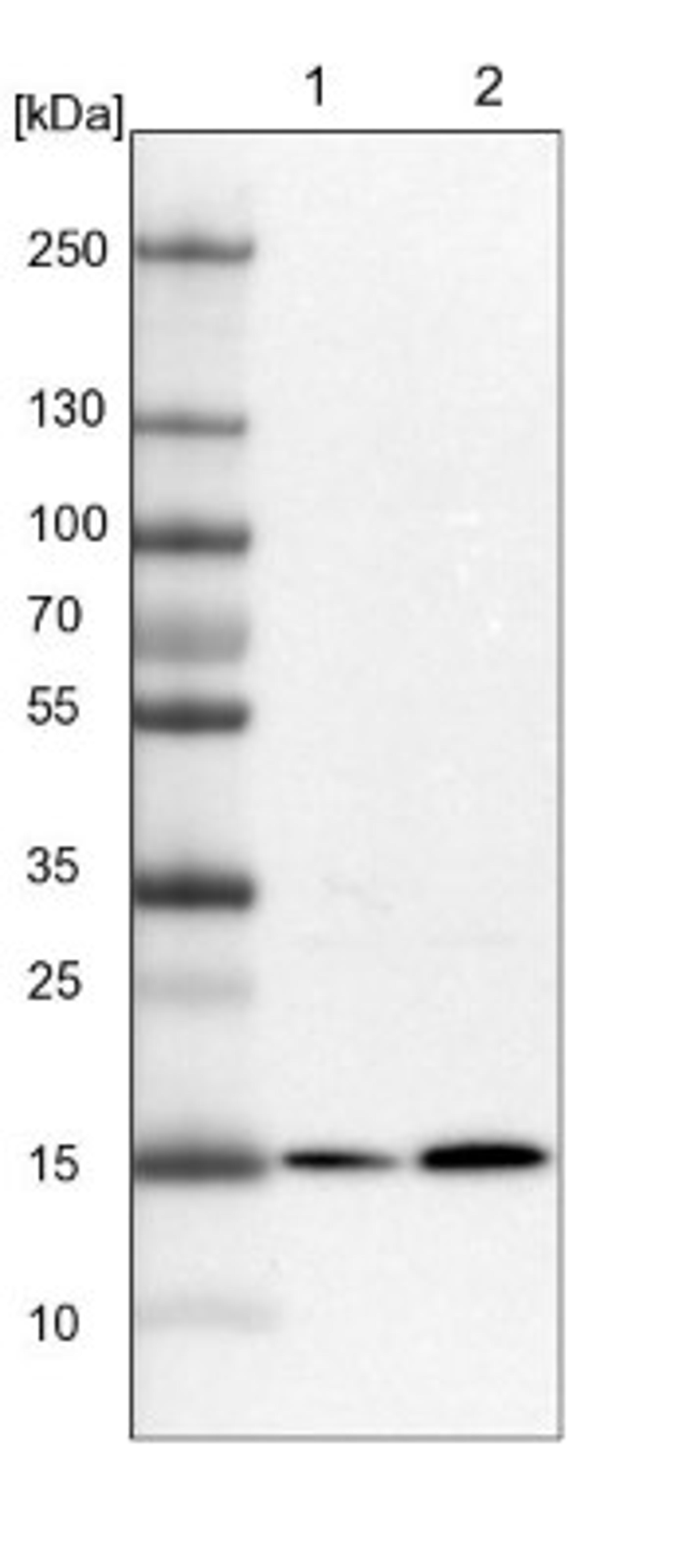 Western Blot: RWDD4A Antibody [NBP1-84743] - Lane 1: Mouse liver tissue lysate<br/>Lane 2: Rat liver tissue lysate