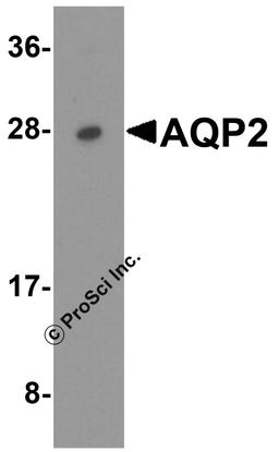 Western blot analysis of AQP2 in A431 cell lysate with AQP2 antibody at 1 μg/ml.