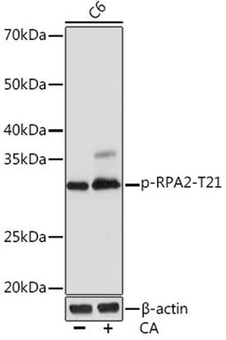 Western blot - Phospho-RPA2-T21 Rabbit mAb (AP1040)