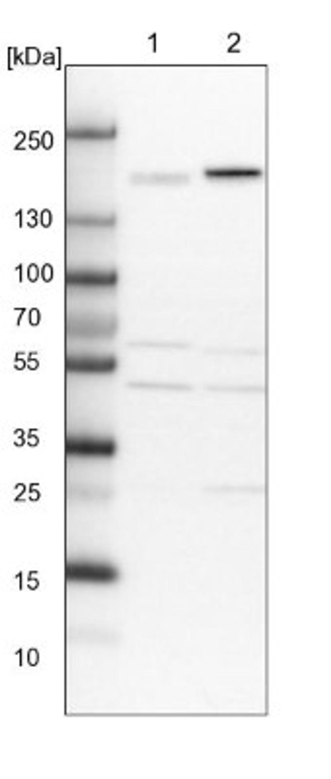 Western Blot: CLIP170 Antibody [NBP1-85568] - Lane 1: NIH-3T3 cell lysate (Mouse embryonic fibroblast cells)<br/>Lane 2: NBT-II cell lysate (Rat Wistar bladder tumour cells)