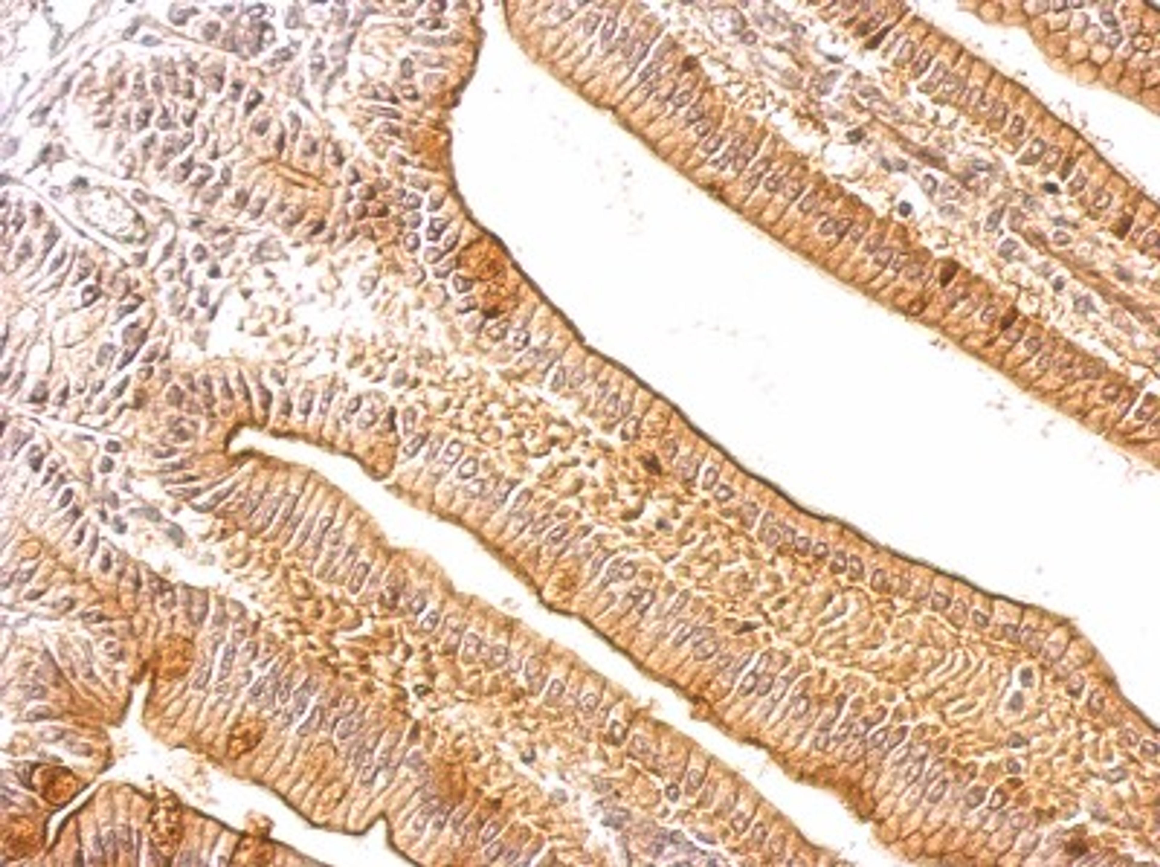 Immunohistochemistry-Paraffin: ACP5 Antibody [NBP1-31535] - Paraffin-embedded mouse intestine tissue; antibody dilution 1:500.