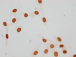 Immunocytochemistry analysis of CSB-PA010376OA21acHU diluted at 1:25 and staining in Hela cells(treated with 30mM sodium butyrate for 4h) performed on a Leica BondTM system. The cells were fixed in 4% formaldehyde, permeabilized using 0.2% Triton X-100 and blocked with 10% normal goat serum 30min at RT. Then primary antibody (1% BSA) was incubated at 4°C overnight. The primary is detected by a biotinylated secondary antibody and visualized using an HRP conjugated SP system.
