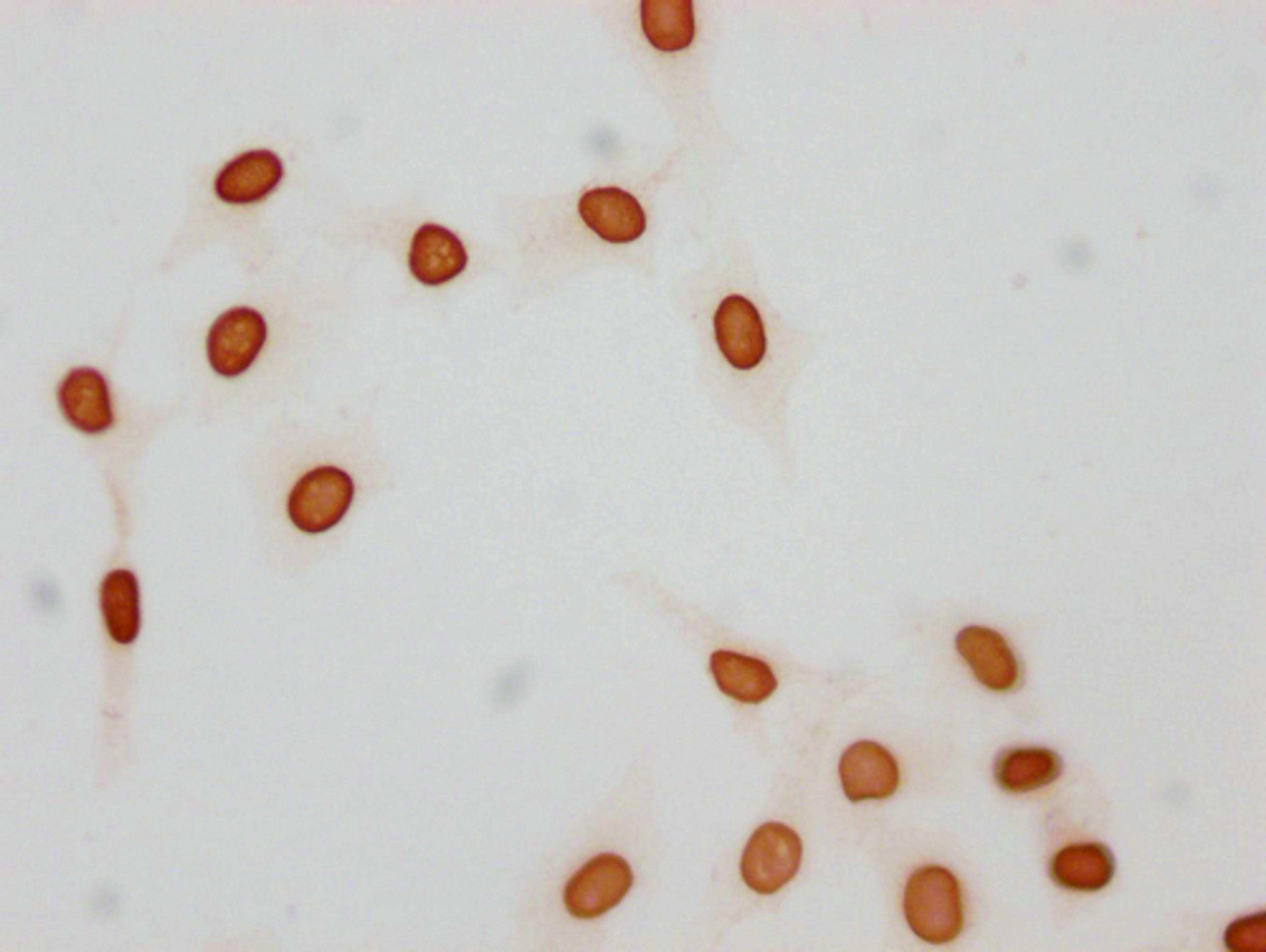Immunocytochemistry analysis of CSB-PA010376OA21acHU diluted at 1:25 and staining in Hela cells(treated with 30mM sodium butyrate for 4h) performed on a Leica BondTM system. The cells were fixed in 4% formaldehyde, permeabilized using 0.2% Triton X-100 and blocked with 10% normal goat serum 30min at RT. Then primary antibody (1% BSA) was incubated at 4°C overnight. The primary is detected by a biotinylated secondary antibody and visualized using an HRP conjugated SP system.
