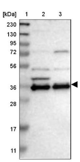 Western Blot: Chondroadherin Antibody [NBP1-87031] - Lane 1: Marker [kDa] 230, 130, 95, 72, 56, 36, 28, 17, 11<br/>Lane 2: Human cell line RT-4<br/>Lane 3: Human cell line U-251MG sp