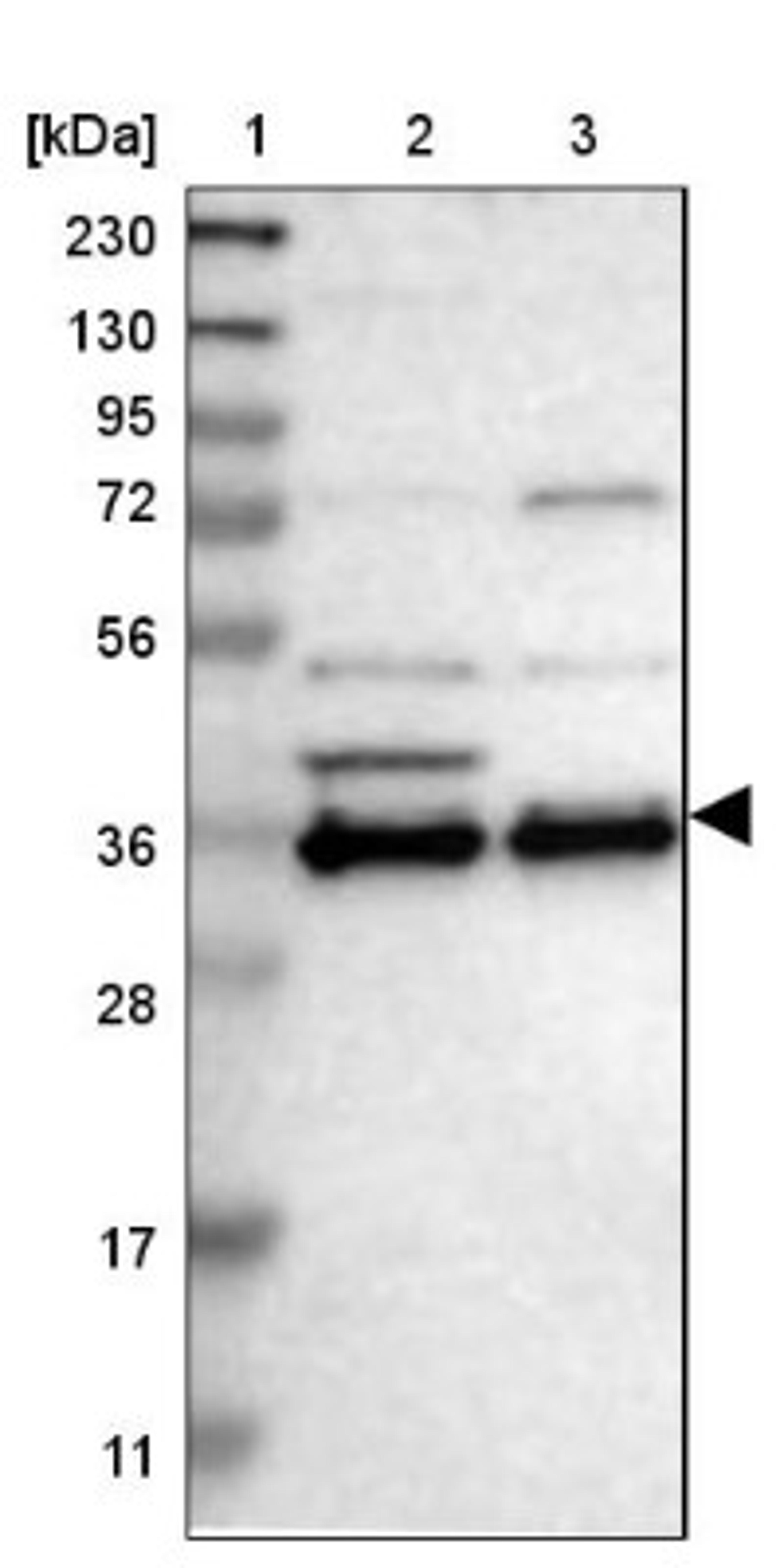 Western Blot: Chondroadherin Antibody [NBP1-87031] - Lane 1: Marker [kDa] 230, 130, 95, 72, 56, 36, 28, 17, 11<br/>Lane 2: Human cell line RT-4<br/>Lane 3: Human cell line U-251MG sp