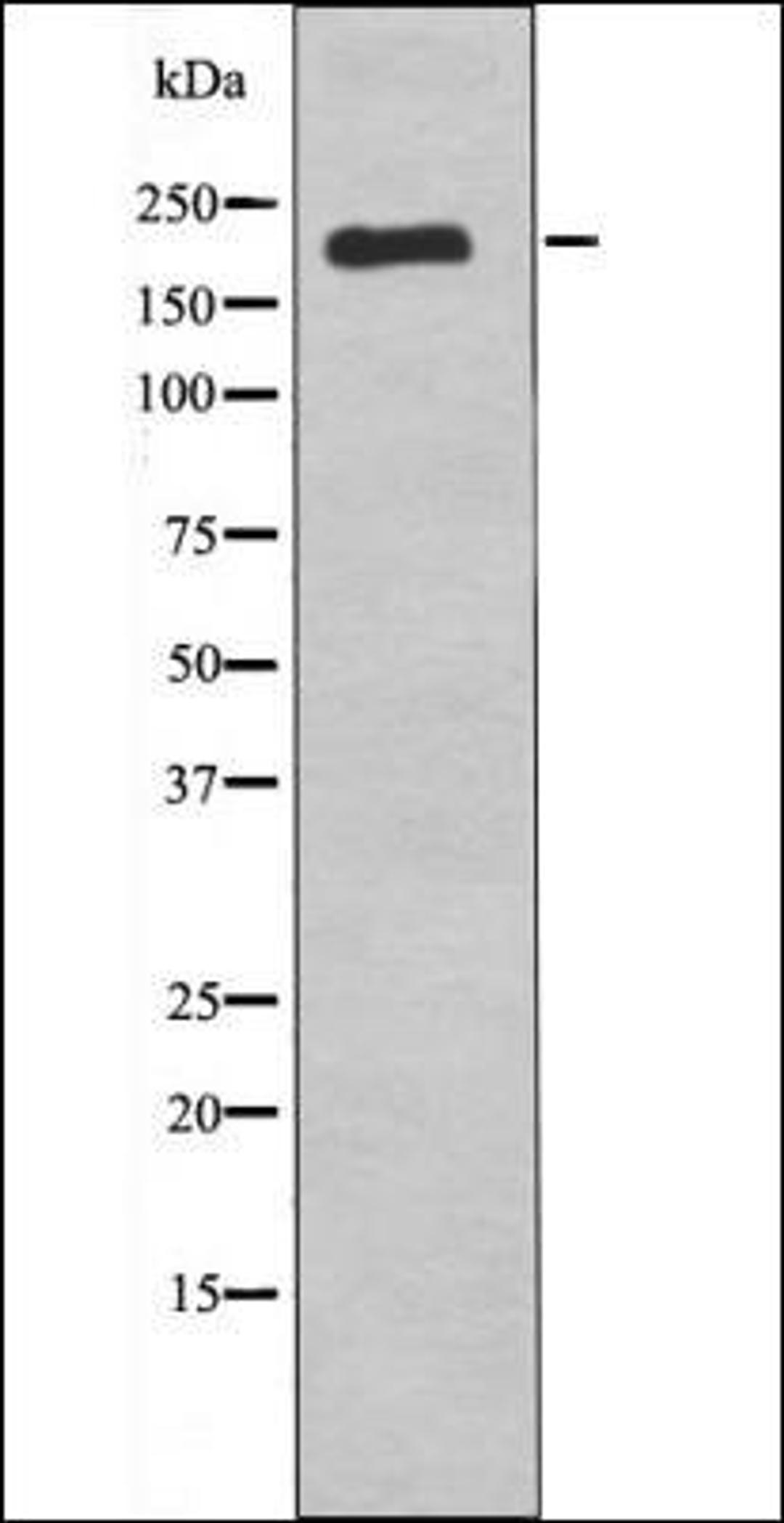 Western blot analysis of nocodazole treated COS7 whole cell lysates using VEGFR1 -Phospho-Tyr1242- antibody