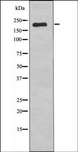 Western blot analysis of nocodazole treated COS7 whole cell lysates using VEGFR1 -Phospho-Tyr1242- antibody