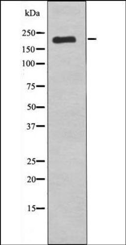 Western blot analysis of nocodazole treated COS7 whole cell lysates using VEGFR1 -Phospho-Tyr1242- antibody