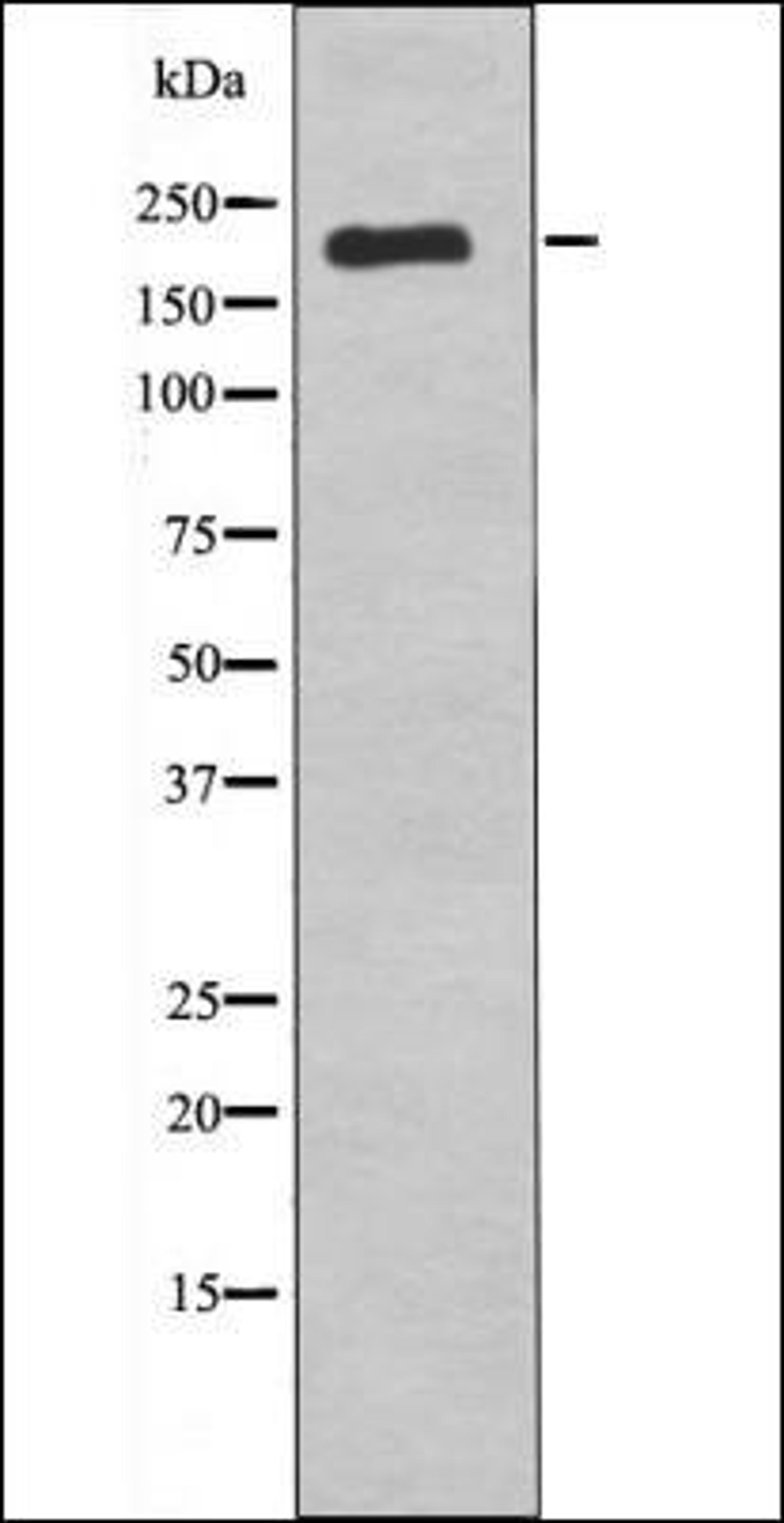 Western blot analysis of nocodazole treated COS7 whole cell lysates using VEGFR1 -Phospho-Tyr1242- antibody