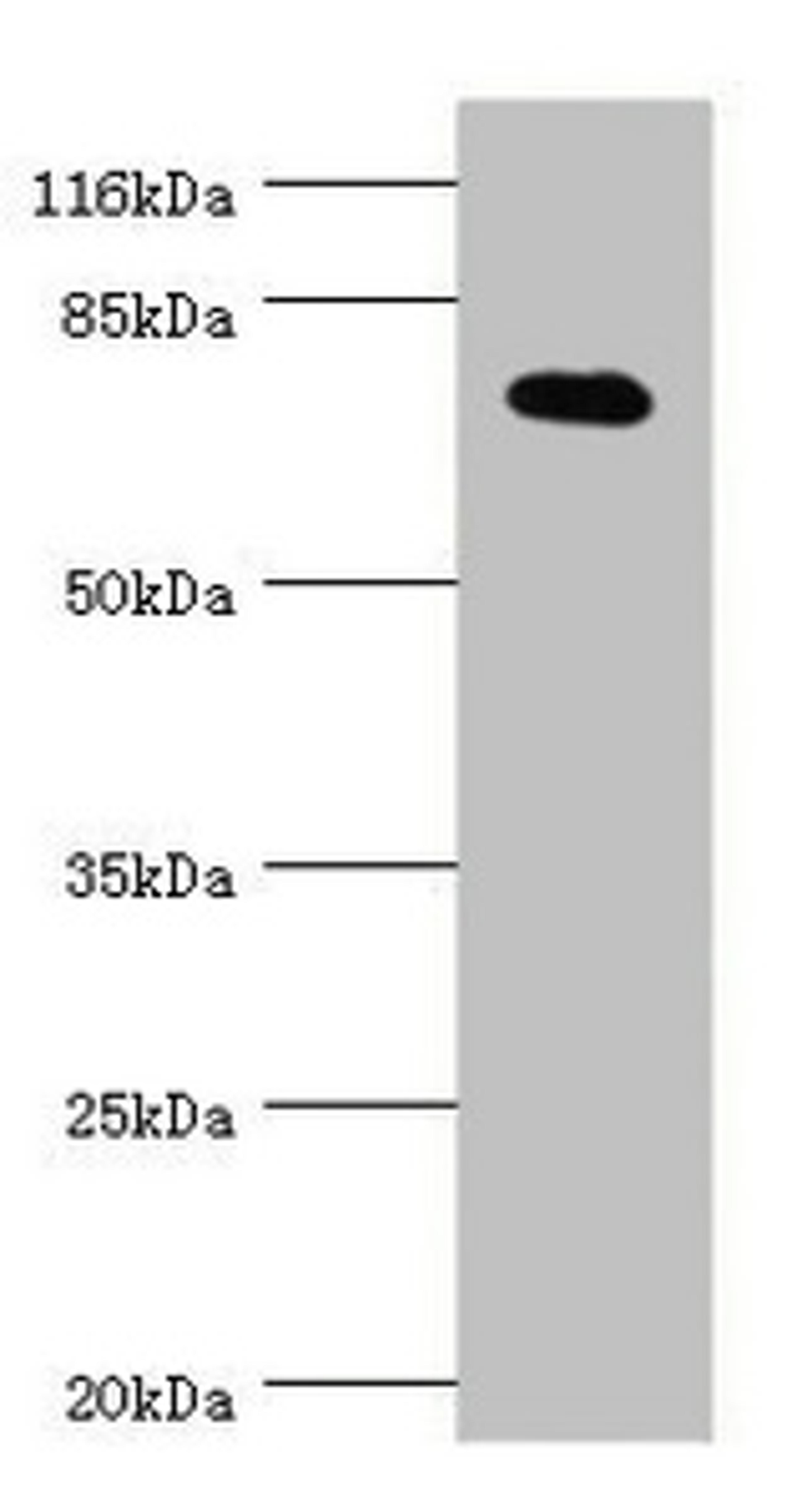 Western blot. All lanes: KCND2 antibody at 0.83µg/ml + THP-1 whole cell lysate. Secondary. Goat polyclonal to rabbit IgG at 1/10000 dilution. Predicted band size: 71 kDa. Observed band size: 71 kDa