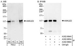 Detection of human ANKLE2 by western blot and immunoprecipitation.