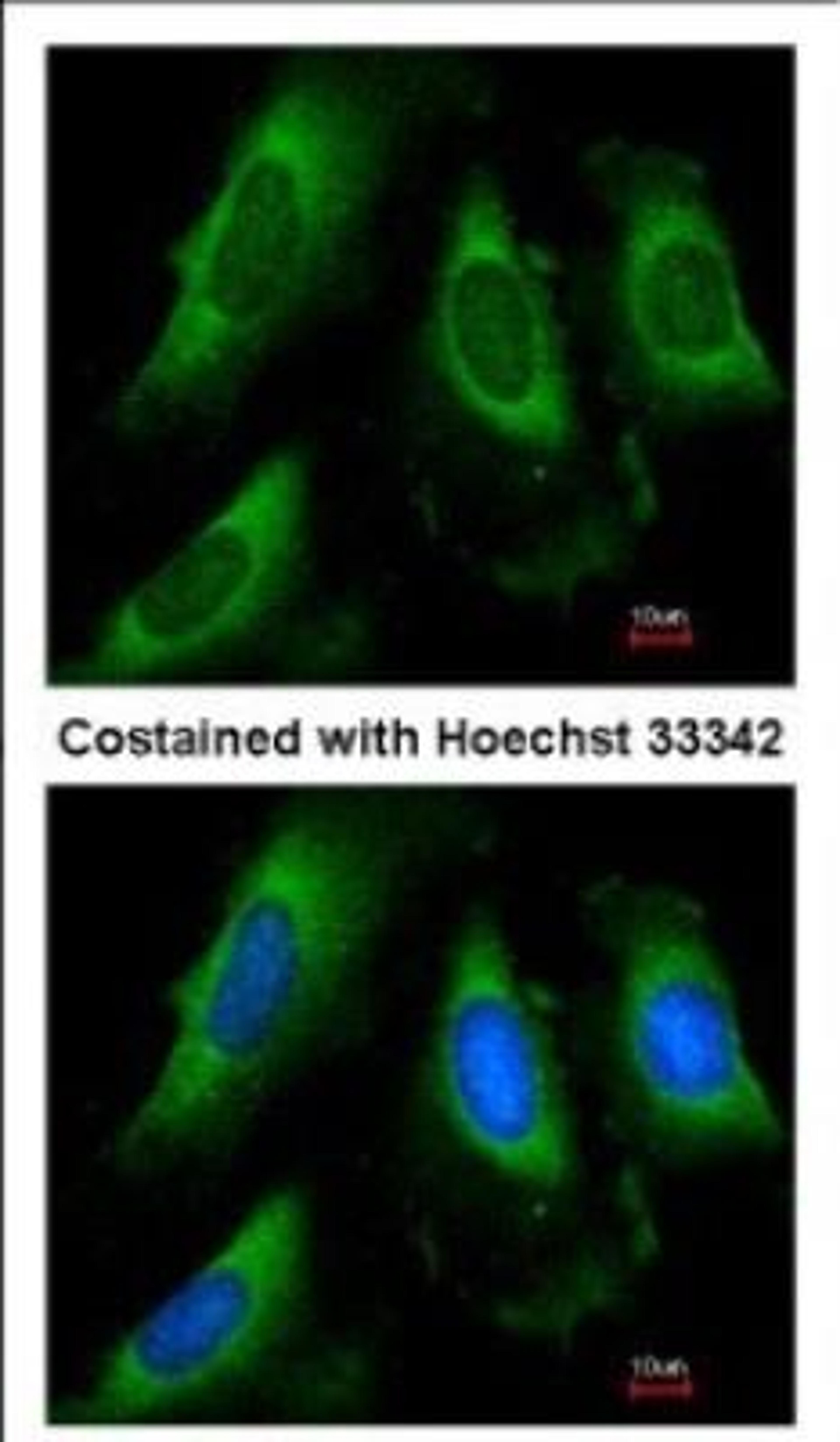 Immunocytochemistry/Immunofluorescence: PGK1 Antibody [NBP2-19784] - Analysis of methanol-fixed HeLa, using antibody at 1:50 dilution.