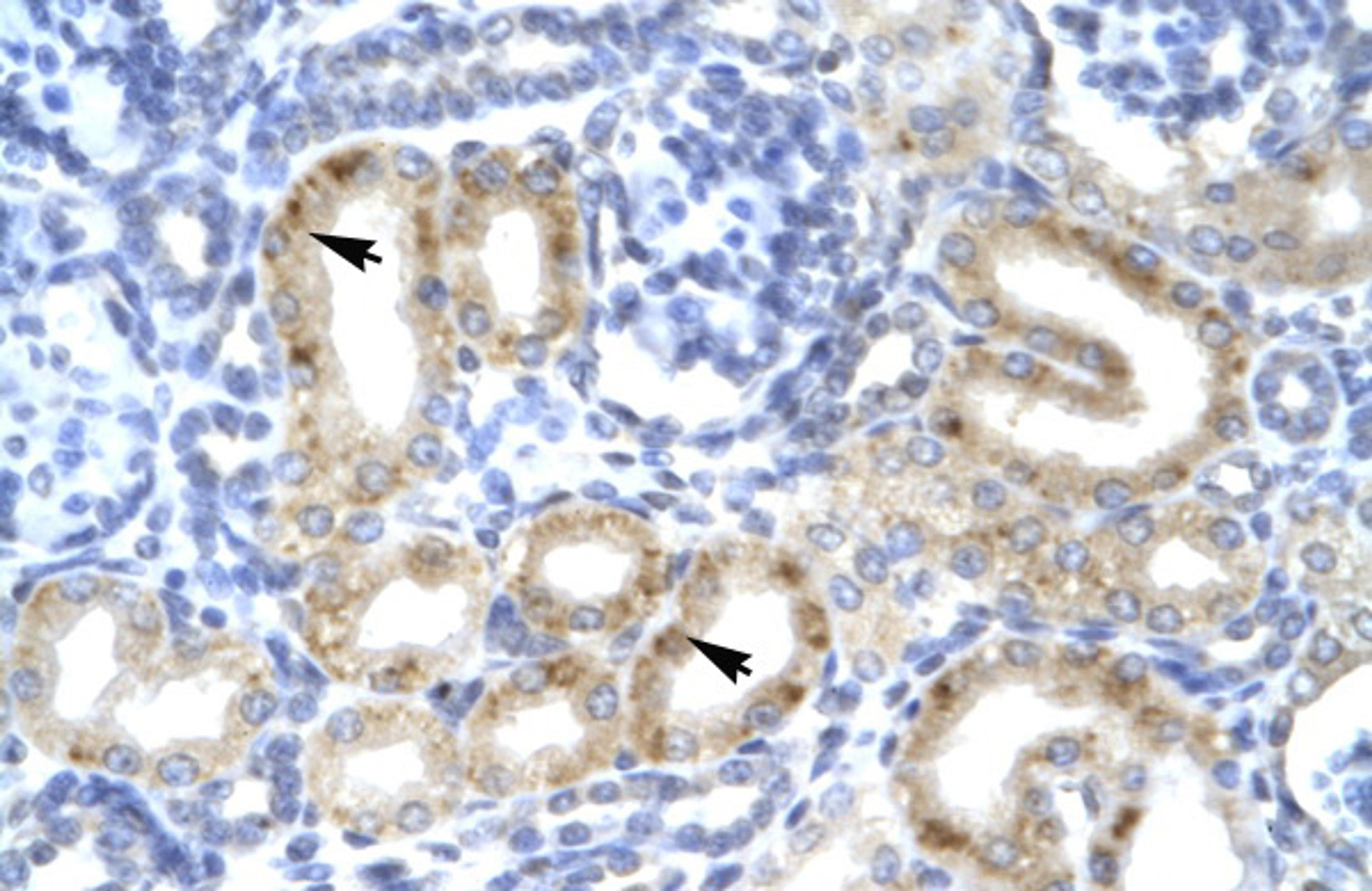 Antibody used in IHC on Human kidney.