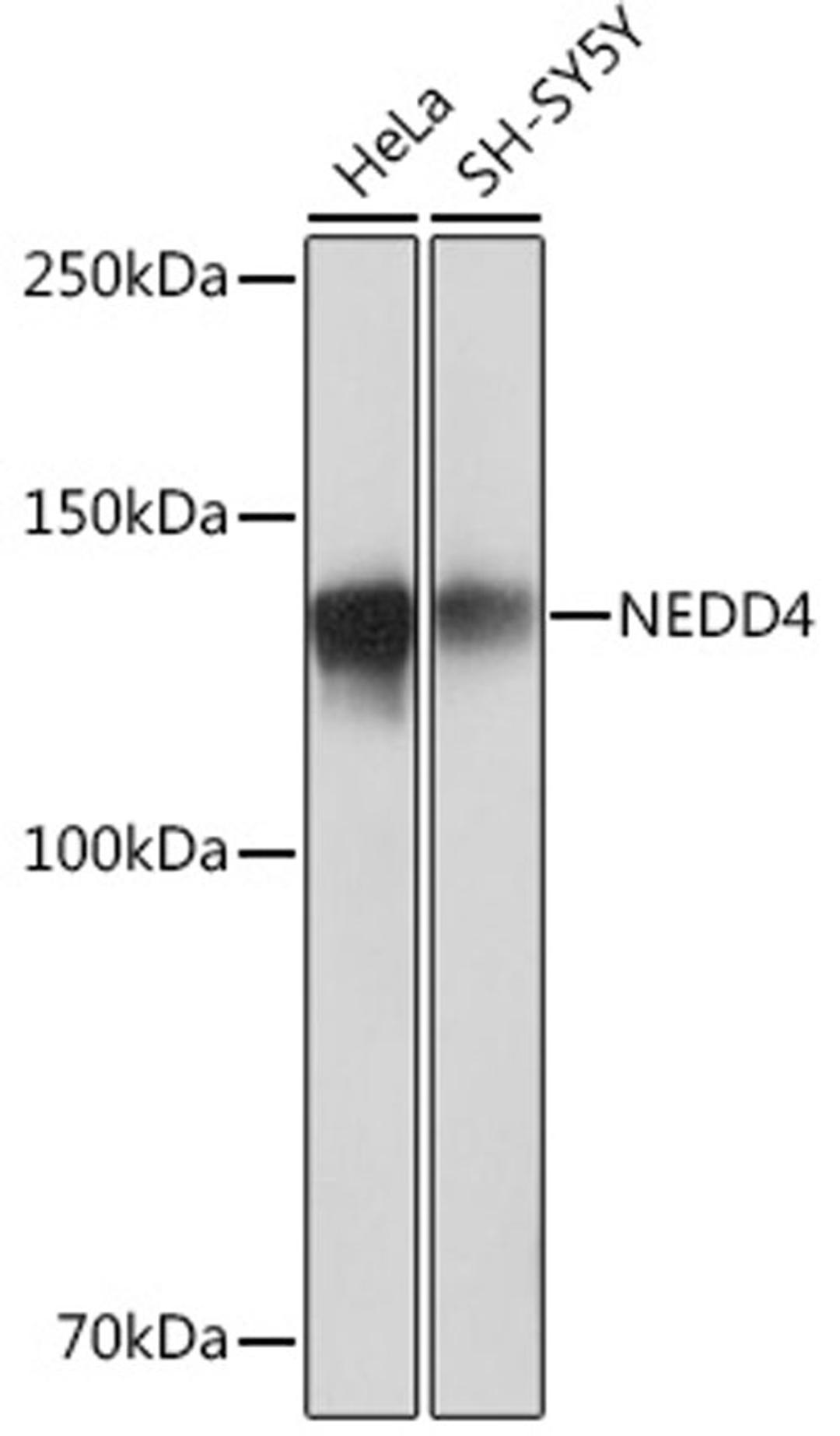 Western blot - NEDD4 Rabbit mAb (A4385)