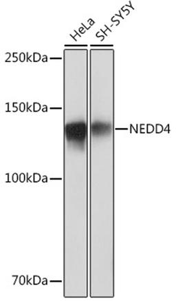 Western blot - NEDD4 Rabbit mAb (A4385)