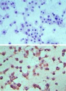 Immunohistochemistry-Paraffin: EDG6 Antibody [NBP2-24500] - Analysis of Edg6/S1P4 in paraffin-embedded formalin-fixed mouse RAW cells using an isotype control (top) and this antibody (bottom) at 5 ug/ml.