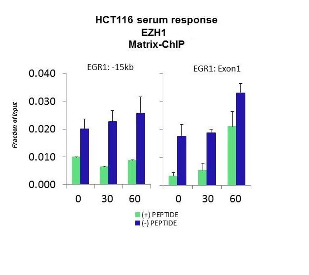 Western blot analysis of HCT116 tissue using EZH1 antibody