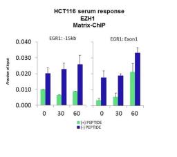 Western blot analysis of HCT116 tissue using EZH1 antibody