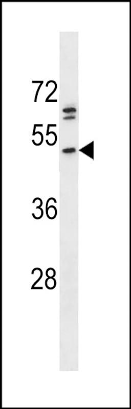 Antibody is used in Western blot to detect PRKACB in A375 cell lysate.