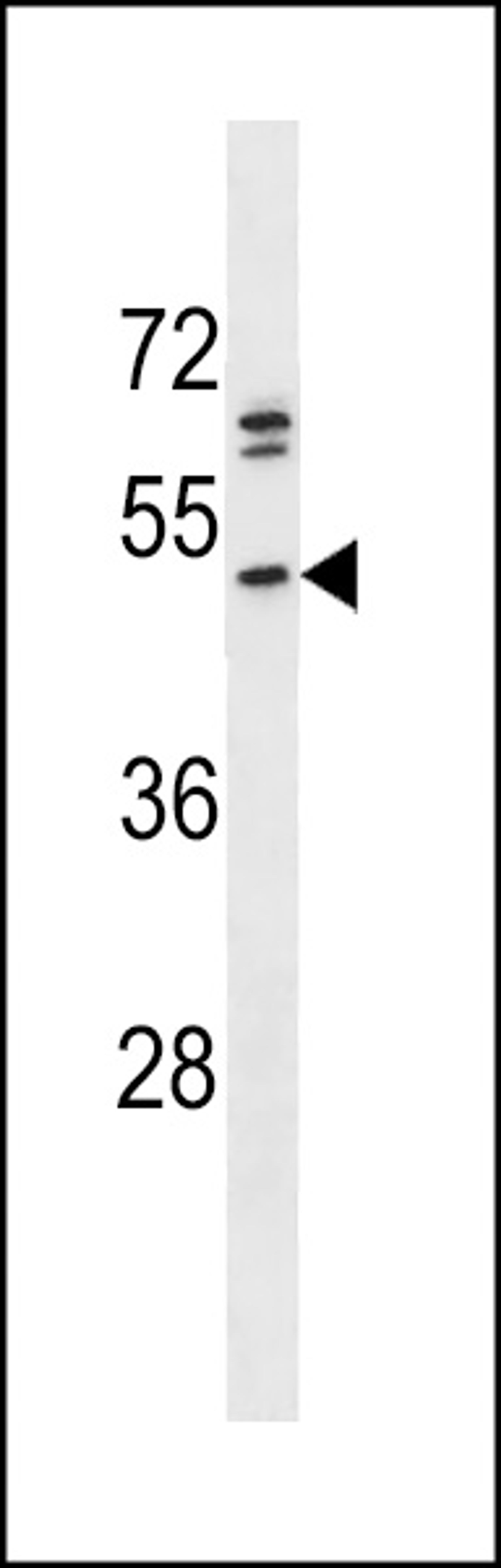 Antibody is used in Western blot to detect PRKACB in A375 cell lysate.