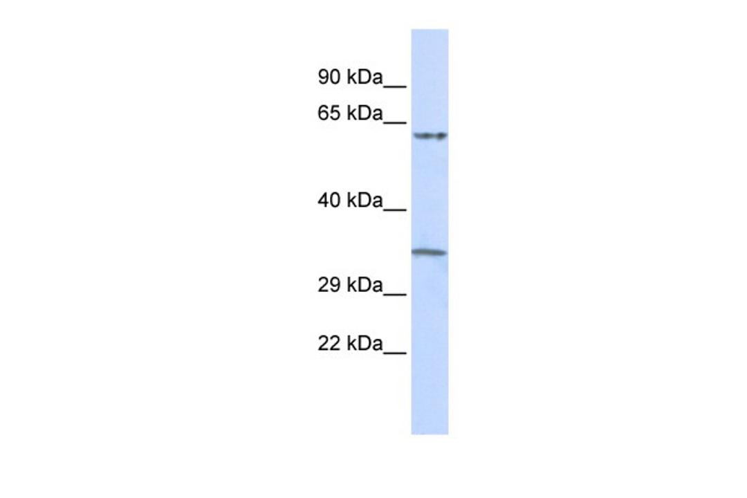 Antibody used in WB on Human Placenta at 0.2-1 ug/ml.