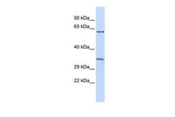 Antibody used in WB on Human Placenta at 0.2-1 ug/ml.