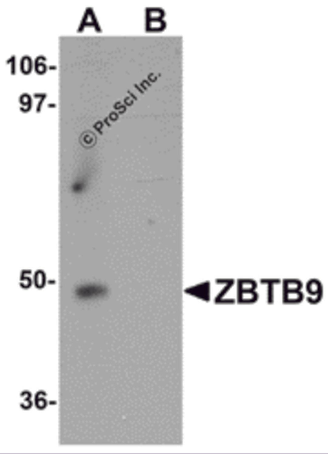 Western blot analysis of ZBTB9 in mouse heart tissue lysate with ZBTB9 antibody at 1 μg/mL in (A) the absence and (B) the presence of blocking peptide.